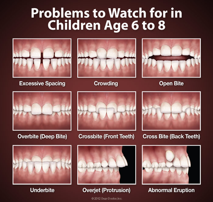 Orthodontic Problems.
